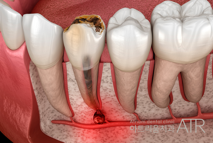 진료노트 본문 이미지