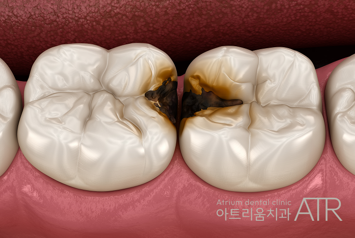 진료노트 본문 이미지