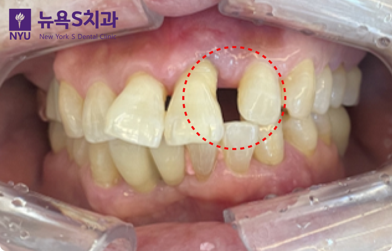 진료노트 본문 이미지