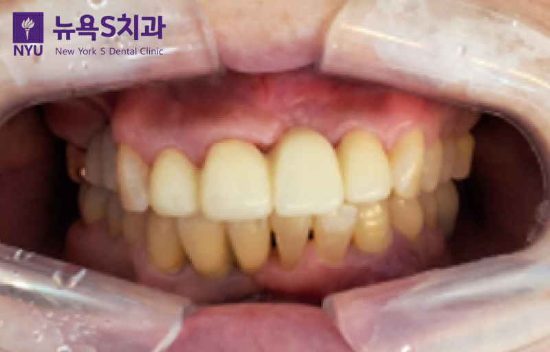 진료노트 본문 이미지