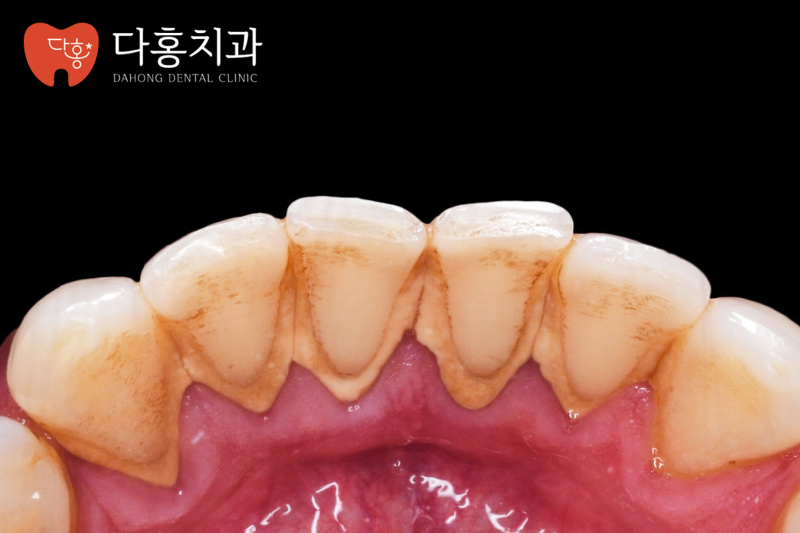 진료노트 본문 이미지