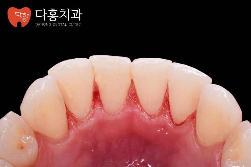 진료노트 본문 이미지