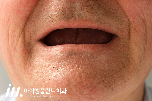 진료노트 본문 이미지