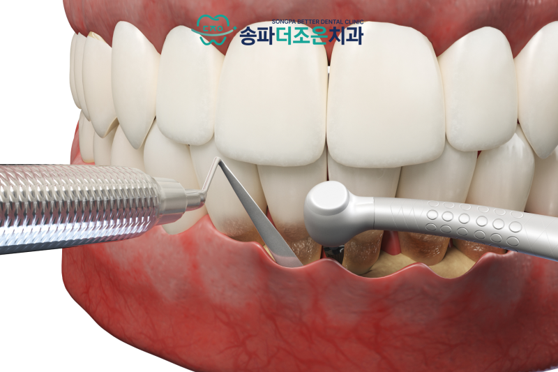 진료노트 본문 이미지