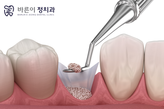 진료노트 본문 이미지