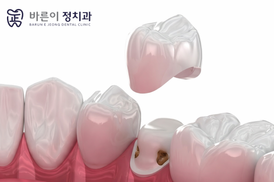 진료노트 본문 이미지