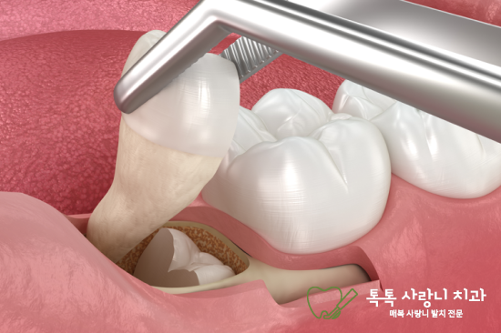 진료노트 본문 이미지
