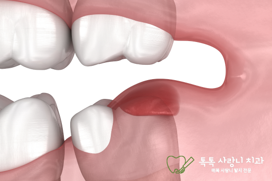 진료노트 본문 이미지