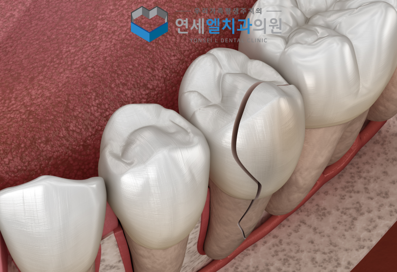 진료노트 본문 이미지