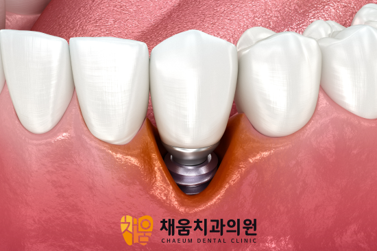 진료노트 본문 이미지