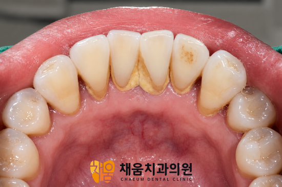 진료노트 본문 이미지