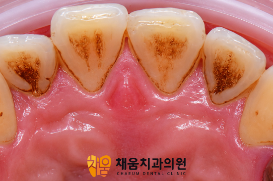 진료노트 본문 이미지