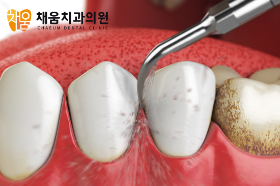 진료노트 본문 이미지