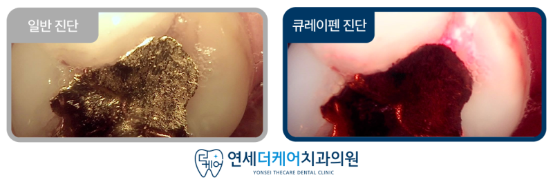 진료노트 본문 이미지