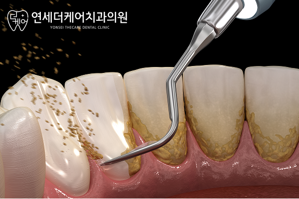진료노트 본문 이미지