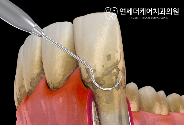 진료노트 본문 이미지