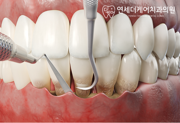 진료노트 본문 이미지