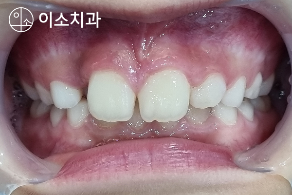 진료노트 본문 이미지