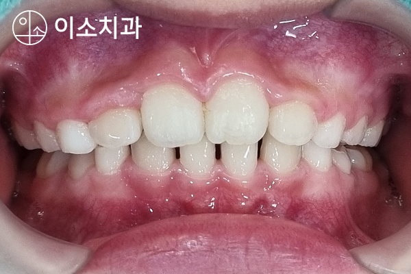 진료노트 본문 이미지