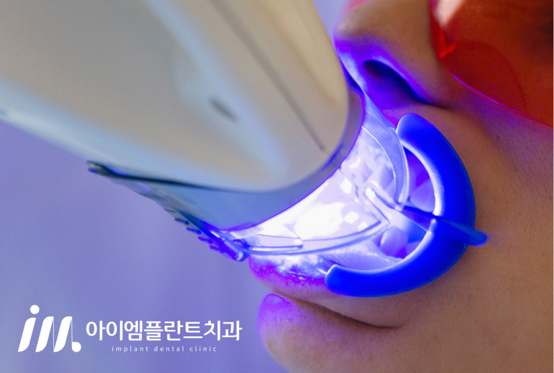 안산 치아미백 가격, 이벤트를 활용해도 괜찮을까? - 1
