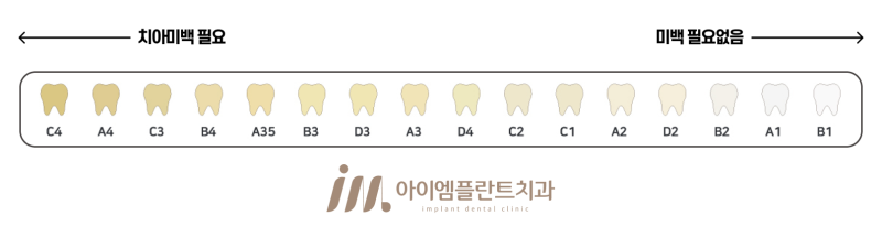 안산 치아미백 가격, 이벤트를 활용해도 괜찮을까? - 4