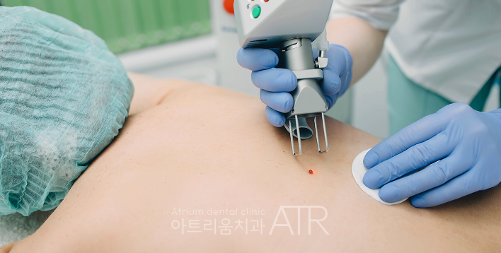 평택 잇몸미백, 검게 변색되는 잇몸의 원인과 치료방법은? - 2