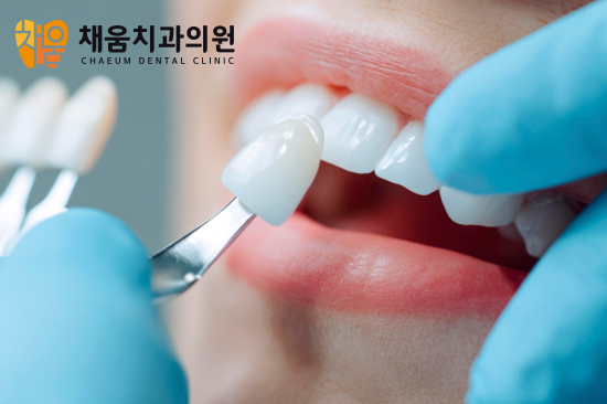 사가정역 라미네이트, 치아삭제는 어느 정도 이루어질까요? - 1