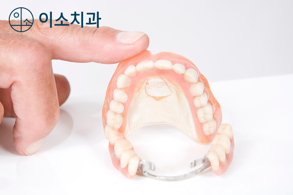 오산 틀니 치과, 틀니와 임플란트 중 하나를 선택해야 한다면? - 1
