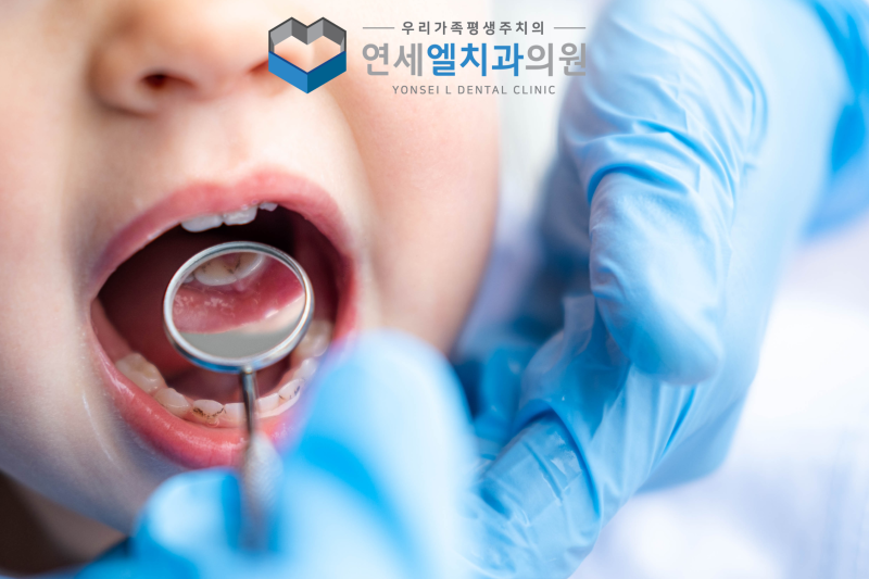 행신동어린이치과, 어린이 실란트 홈메우기, 꼭 필요한 치료일까요? - 3