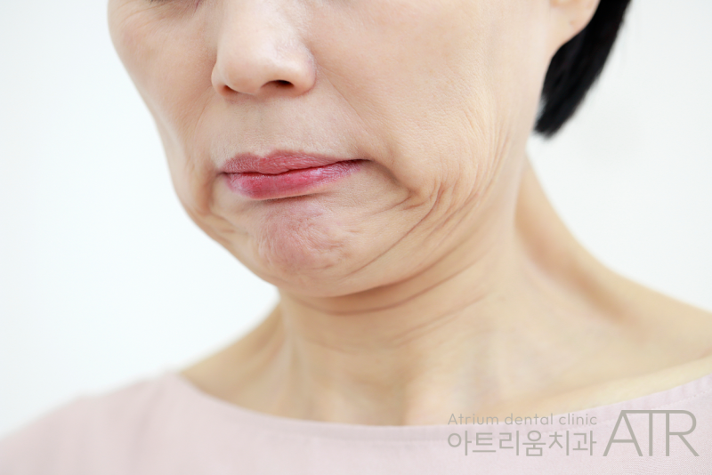 평택 치아 실금, 유독 씹을 때만 아프다면? 크랙 가능성이 있습니다 - 2
