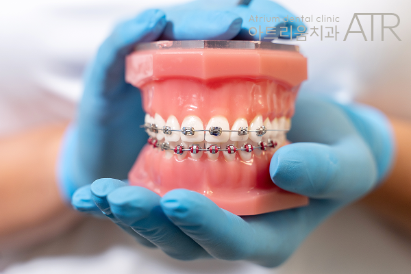 평택 투명교정, 미리 장치 교정했던 사람들이 후회하는 대표적인 이유 - 2