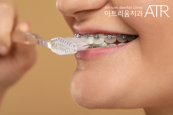 평택 투명교정, 미리 장치 교정했던 사람들이 후회하는 대표적인 이유 - 3