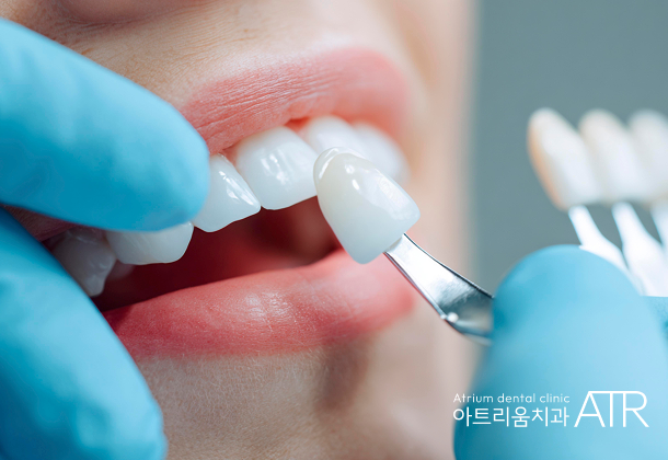 비전동 치아미백 치과, 아트리움치과가 하루에 여러 번 시술하지 않는 이유 - 2