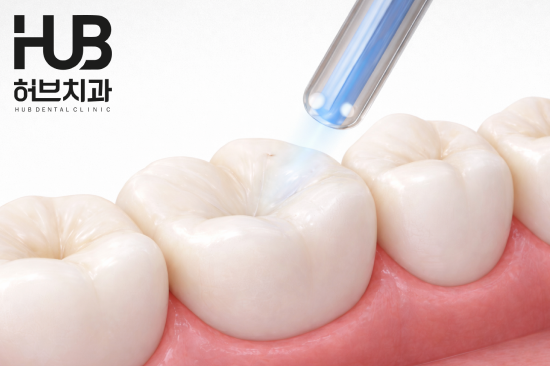 아산충치치료, 단 음식 먹을 때 찌릿한 통증 왜 생길까요? - 3