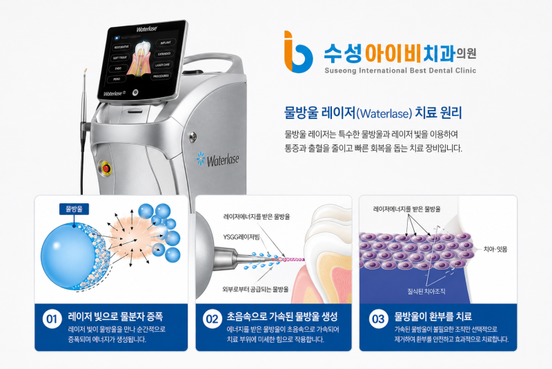 대구잇몸성형, 잇몸이 과도하게 보이는 거미스마일 치료 자연스러운 미소를 위해 먼저 확인하는 것 - 2