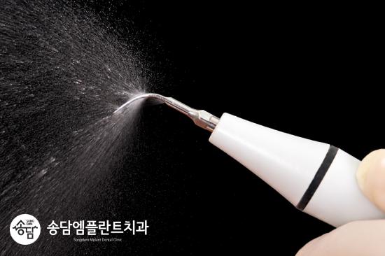 안중읍치과, 스케일링을 하면 치아가 깎인다는 말 사실일까요? - 1