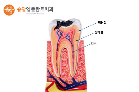 안중 치과, 정기검진이 중요한 이유 알고 계시나요? - 1