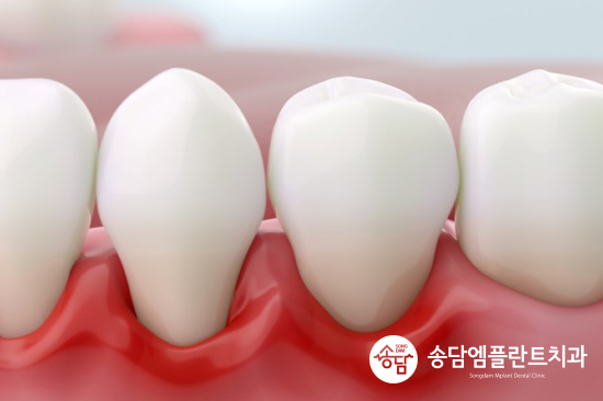 안중 치과, 정기검진이 중요한 이유 알고 계시나요? - 2