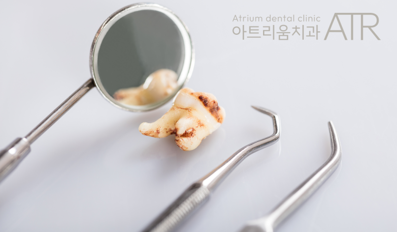 평택 사랑니 치과, 안 아프게 잘 뽑아주는 곳 없을까 고민 중이시라면?