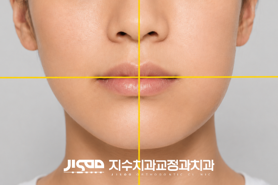 동성로 안면비대칭 교정, 좌우 교합 차이도 비대칭의 원인이 될 수 있습니다 - 2