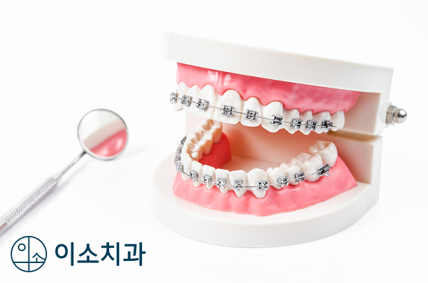 오산 안면비대칭, 치아교정만으로 가능할까? - 3