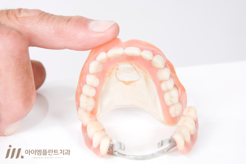 안산 고잔역 임플란트 잘하는 곳, 임플란트 틀니가 궁금하시다면 - 3