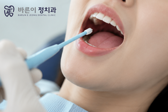 상계동 충치예방, 성인도 불소도포를 받을 필요가 있을까요?