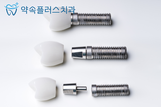 지제역 임플란트 저렴한 곳보다는 '이런 기준'으로 살펴보세요 - 4