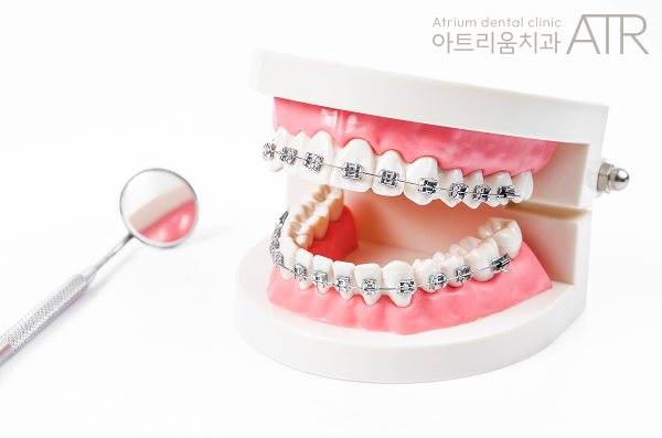 평택 안면비대칭, 치아교정만으로 개선될 수 있을까요? - 2