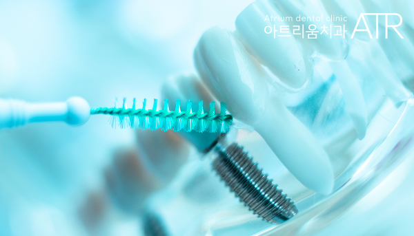 평택 임플란트, 임플란트 후 음식물 끼임 정상인가요?