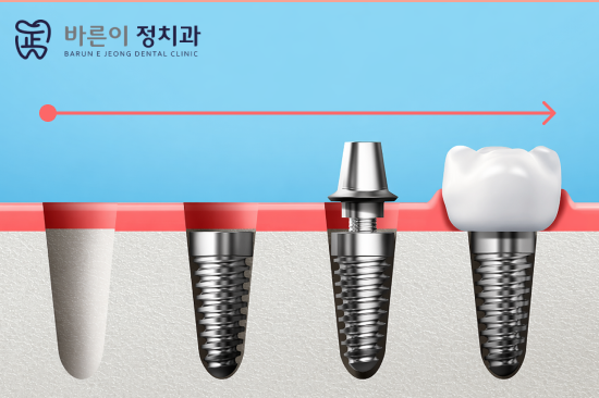 노원역 임플란트 잘하는 곳은 계획부터 다릅니다 - 2