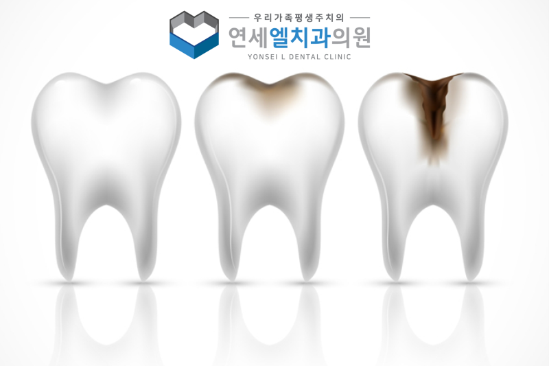 능곡역 양심치과, 과잉진료 없는 치과를 찾는다면, 치료 전 이것부터 확인해 보세요 - 3