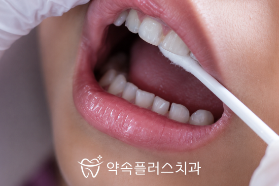 지제역 자이 치과, 불소도포는 어린이만 받는 치료가 아닙니다