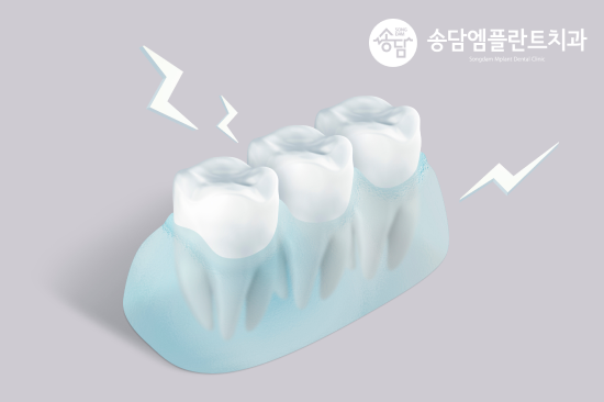 화양지구치과, 치아가 시릴 때 의심해 볼 수 있는 대표적인 질환
